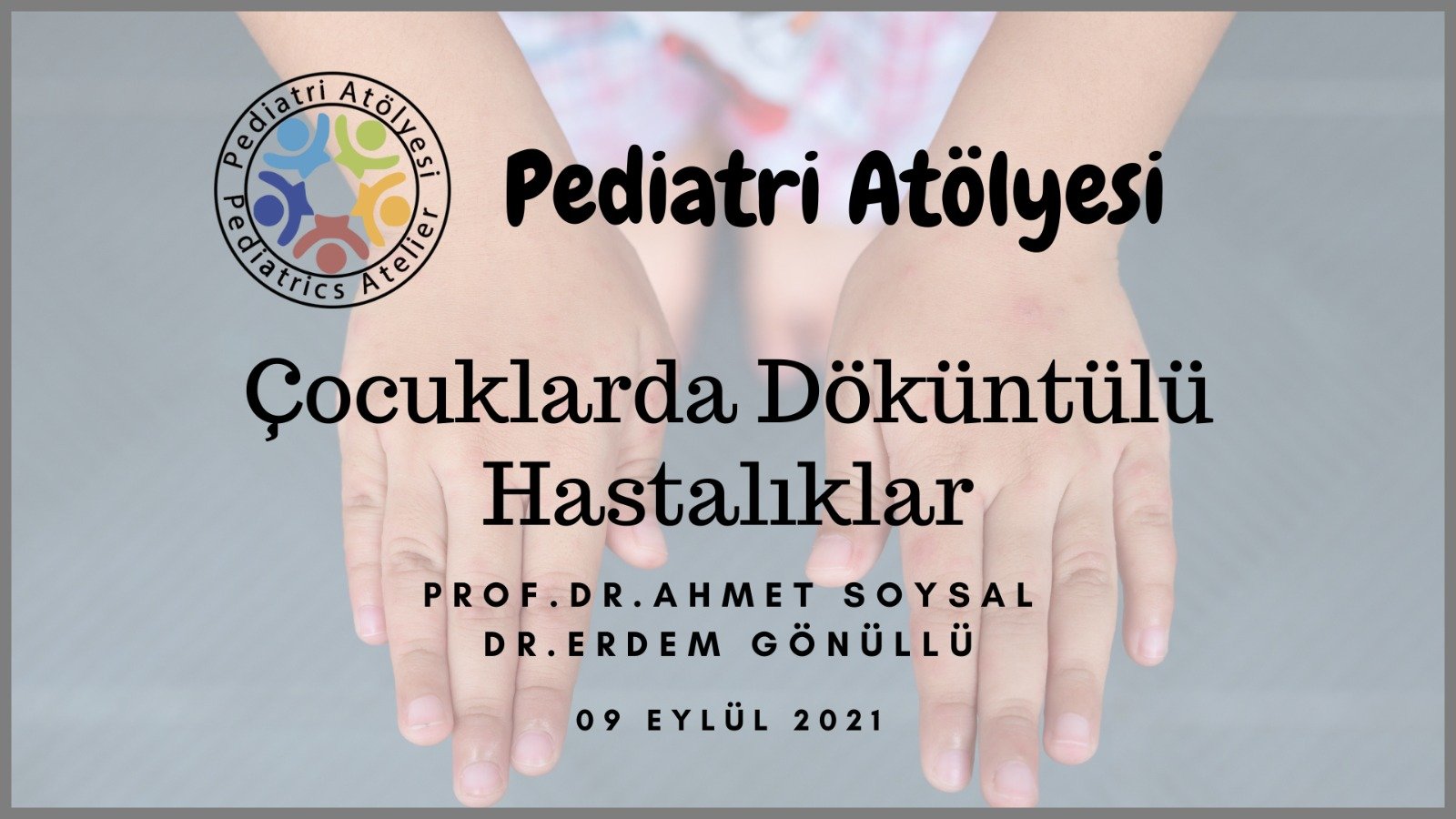 Çocuklarda Döküntülü Hastalıklar