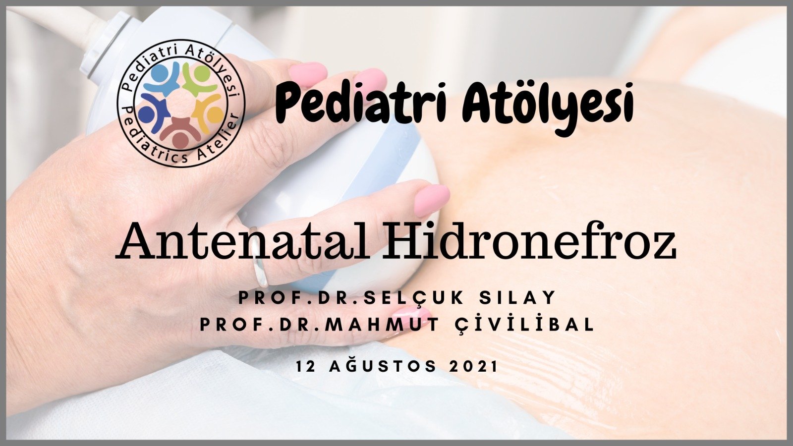 Antenatal Hidronefroz